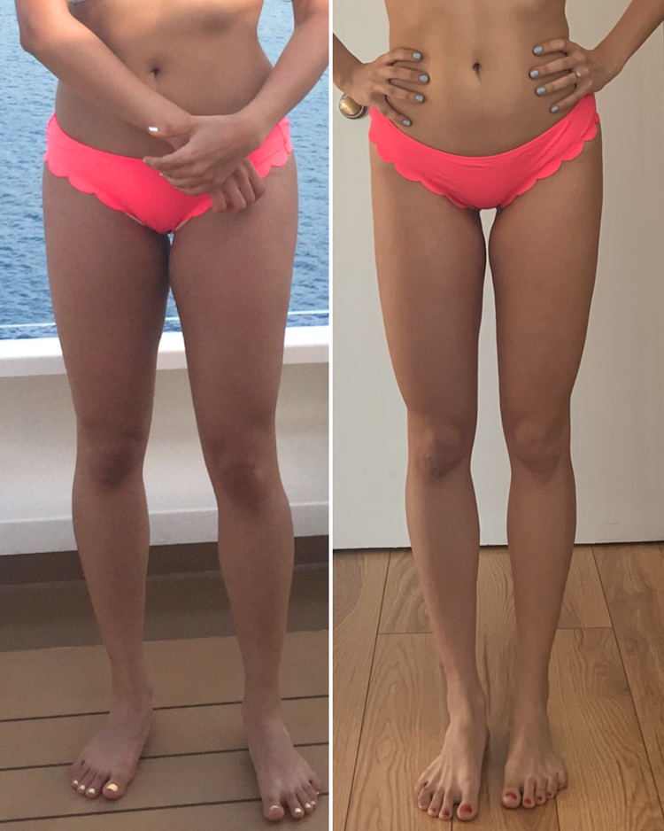 legs transformation through lean legs program