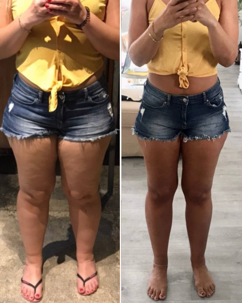 legs transformation through lean legs prorgam